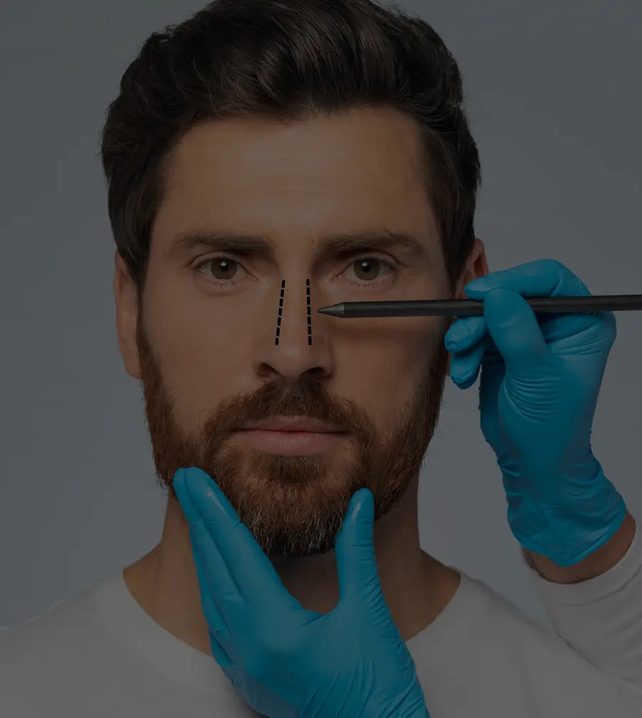 Rhinoplastie