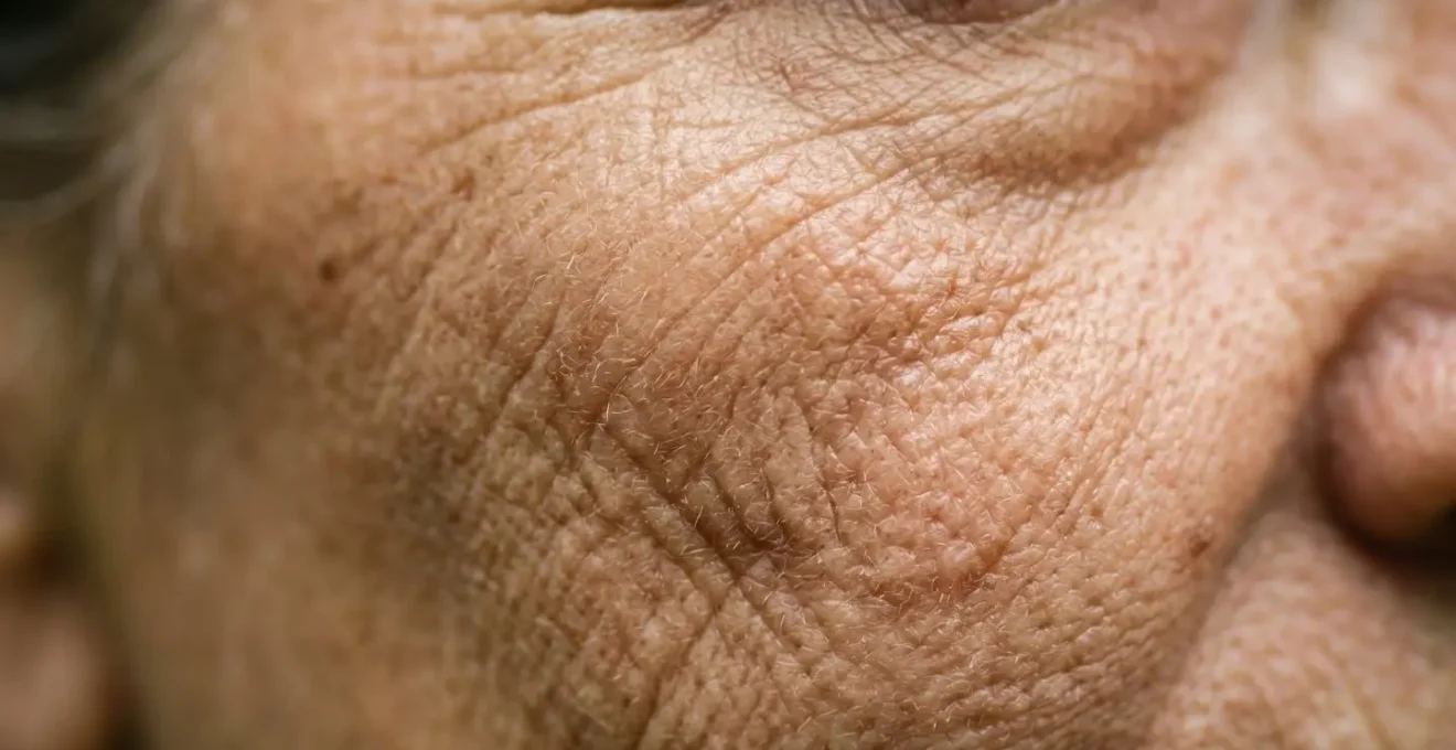 Dettaglio macro della texture della pelle che mostra gli effetti dell'invecchiamento accelerato