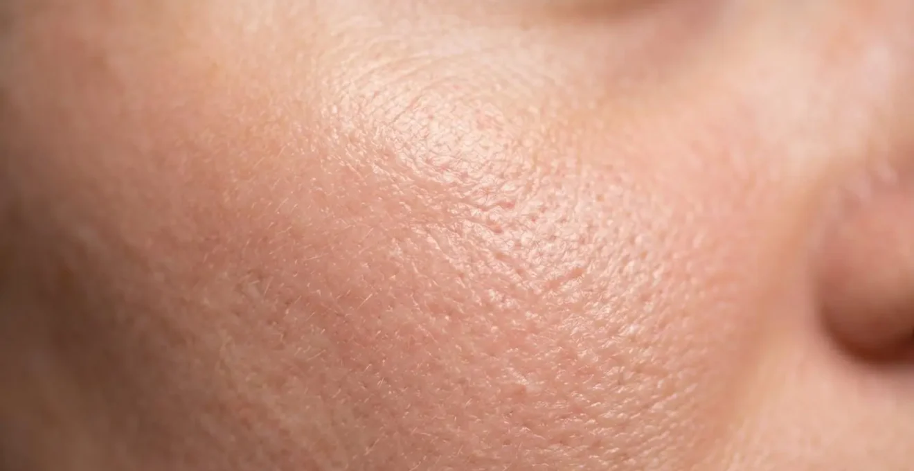 Dettaglio macro della texture della pelle con microcircolazione visibile
